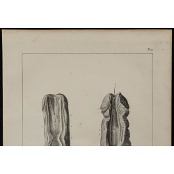 1839 - Urètre et verge incisée 