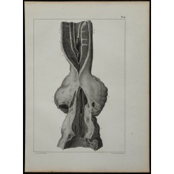 1839 - Urètre rétréci & prostate 