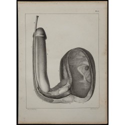 1839 - Vessie et verge pathologique 