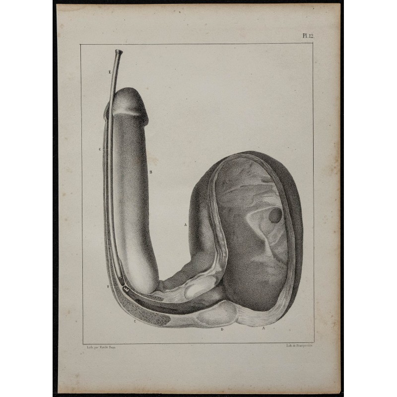 1839 - Vessie et verge pathologique 