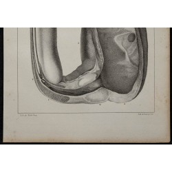 1839 - Vessie et verge pathologique 
