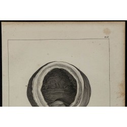 1839 - Prostate et vessie anormale 