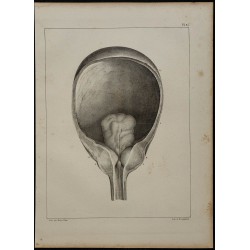 1839 - Luette vésicale et prostate 
