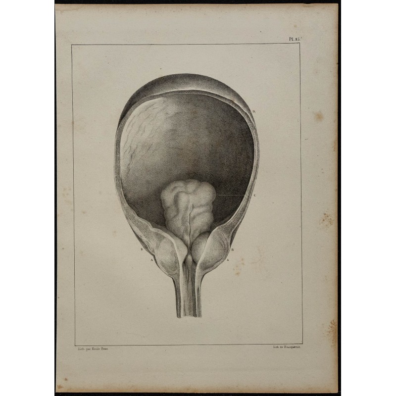 1839 - Luette vésicale et prostate 