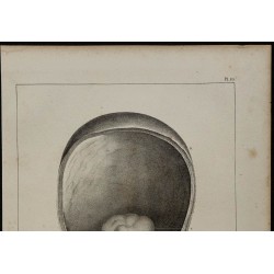 1839 - Luette vésicale et prostate 