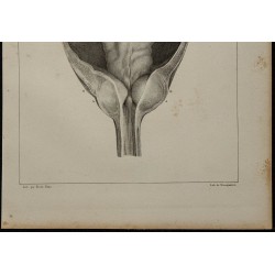 1839 - Luette vésicale et prostate 