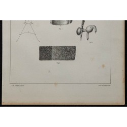 1839 - Utérus gravidique et anévrisme 