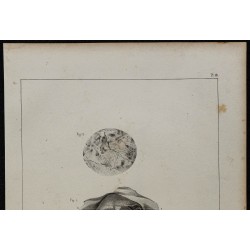 1839 - Testicule avec caillots 