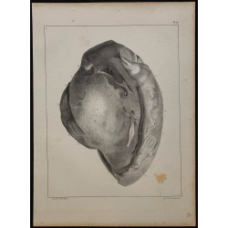 1839 - Testicule et vaisseaux 