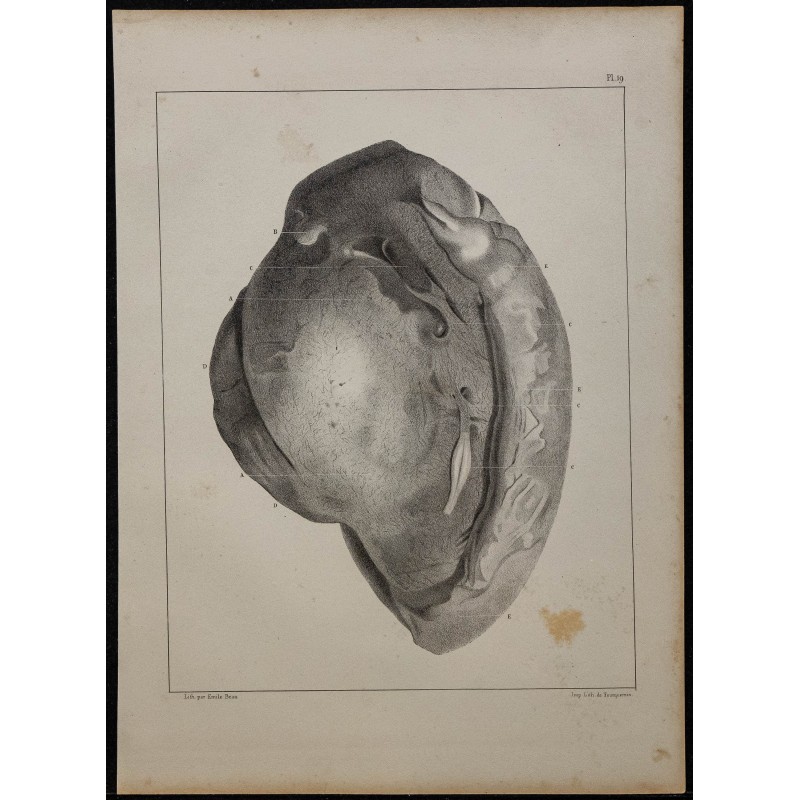 1839 - Testicule et vaisseaux 