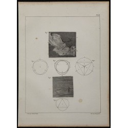 1839 - Inflammation intestinale et valvules 