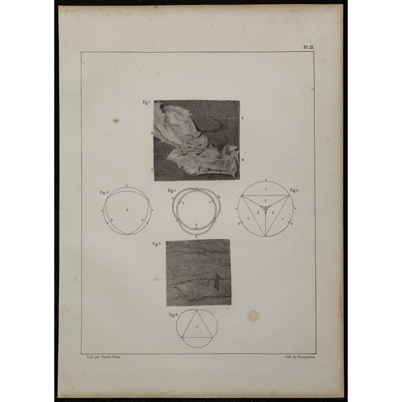 1839 - Inflammation intestinale et valvules 