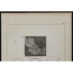 1839 - Inflammation intestinale et valvules 