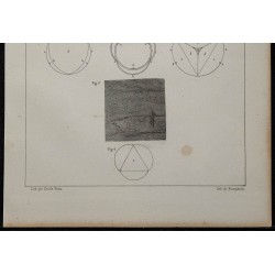1839 - Inflammation intestinale et valvules 