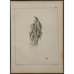 1839 - Expectorations et bronches pathologie 