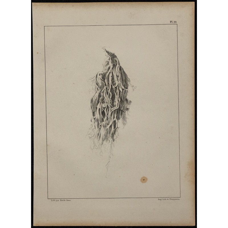 1839 - Expectorations et bronches pathologie 