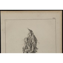 1839 - Expectorations et bronches pathologie 