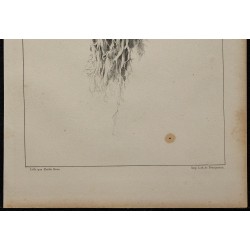 1839 - Expectorations et bronches pathologie 