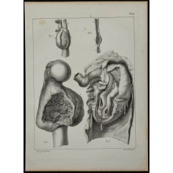 1839 - Anévrismes, articulations et intestin 