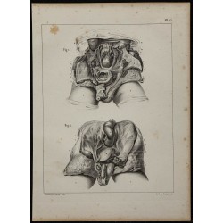 1839 - Descente testiculaire fœtale 