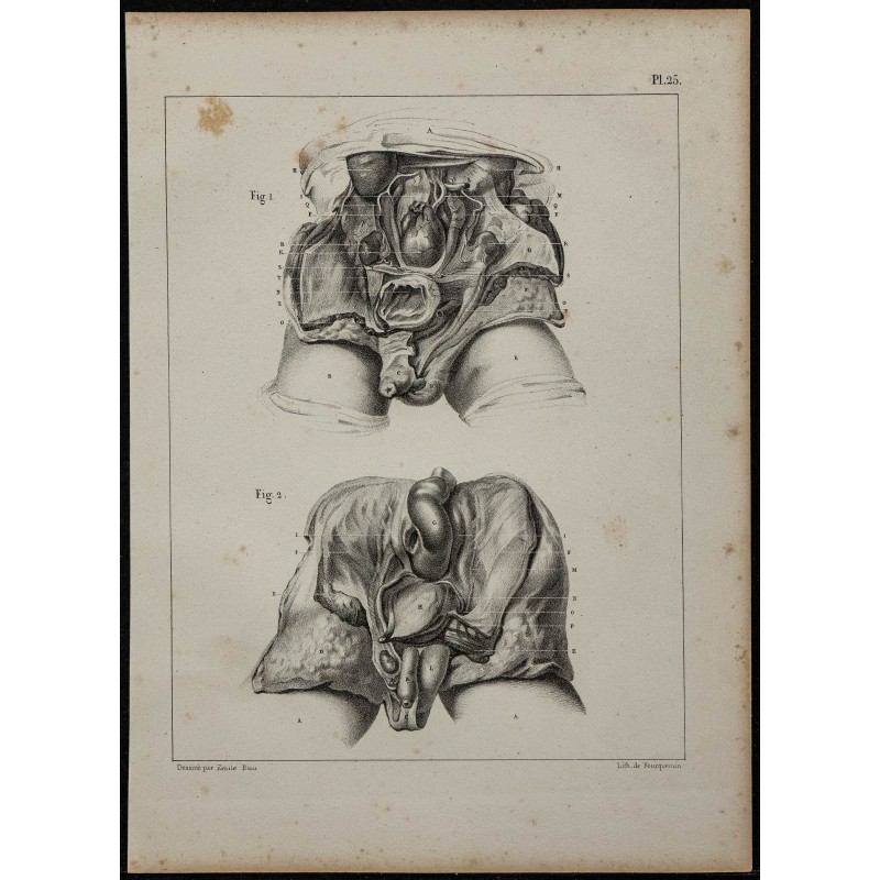 1839 - Descente testiculaire fœtale 