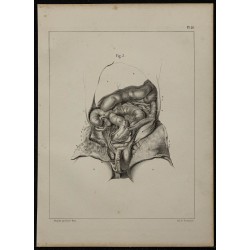 1839 - Organes génitaux fœtus disséqués 