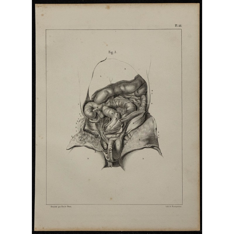 1839 - Organes génitaux fœtus disséqués 