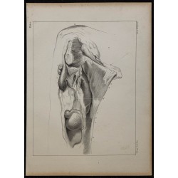 1839 - Descente des testicules bélier 