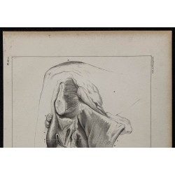 1839 - Descente des testicules bélier 