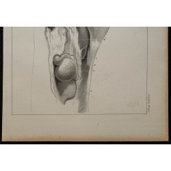 1839 - Descente des testicules bélier 