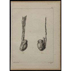 1839 - Anomalies des testicules 