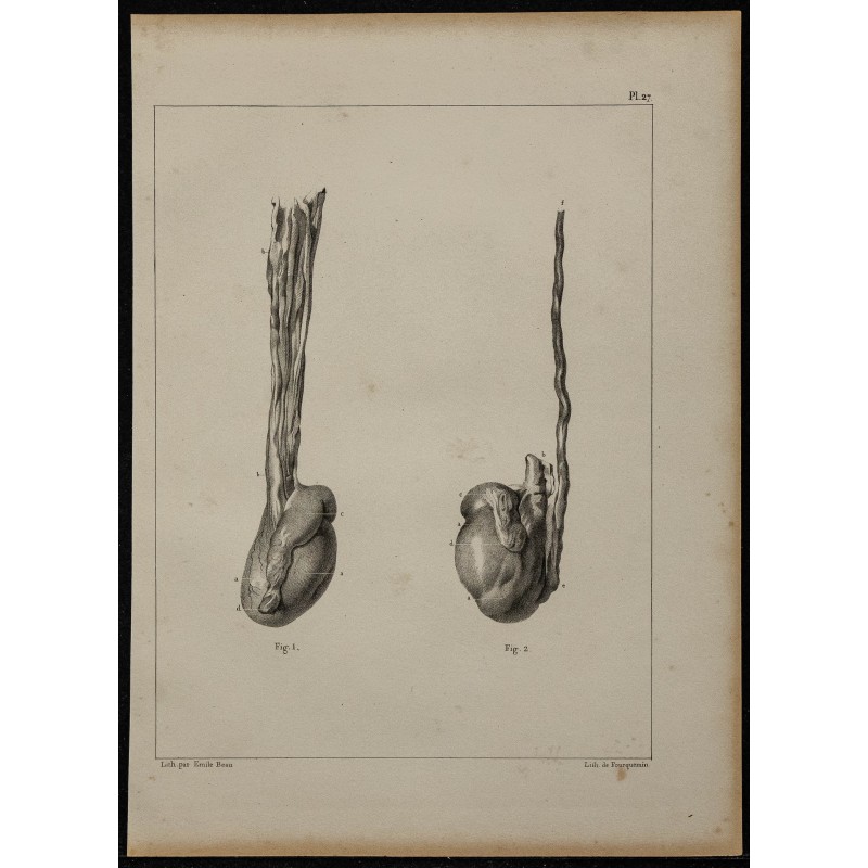 1839 - Anomalies des testicules 