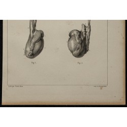 1839 - Anomalies des testicules 