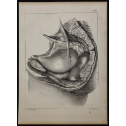 1839 - Bassin masculin disséqué 