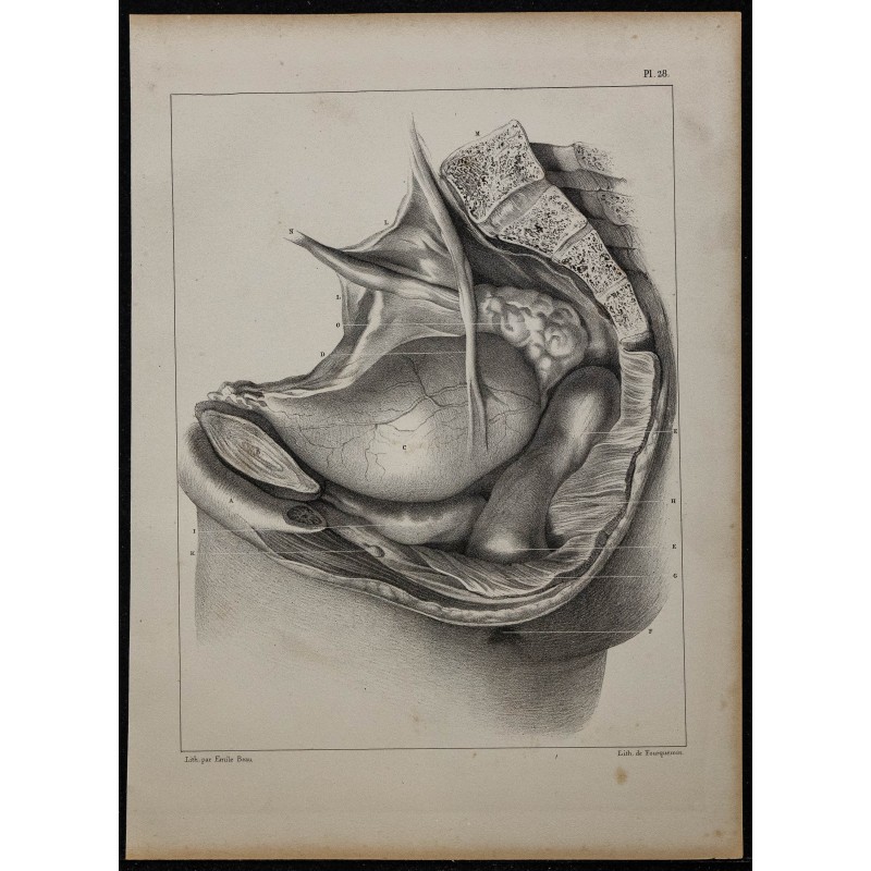 1839 - Bassin masculin disséqué 