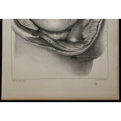 1839 - Bassin masculin disséqué 