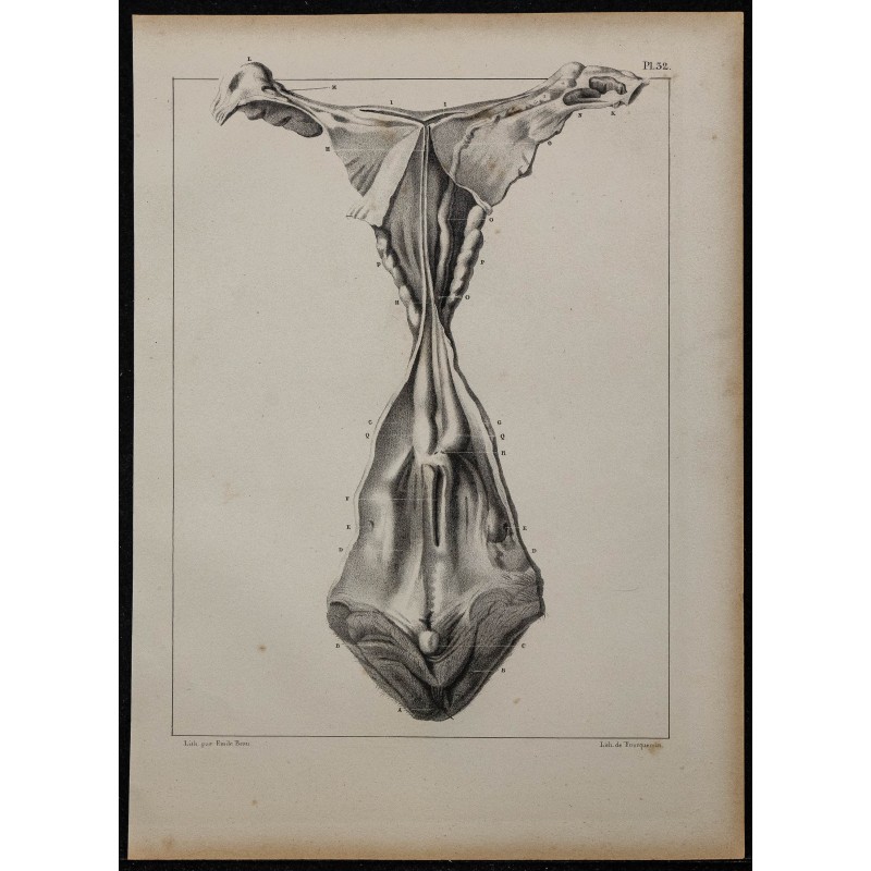 1839 - Organes génitaux free-martin 