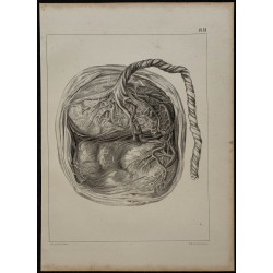 1839 - Placenta bilobé de singe 