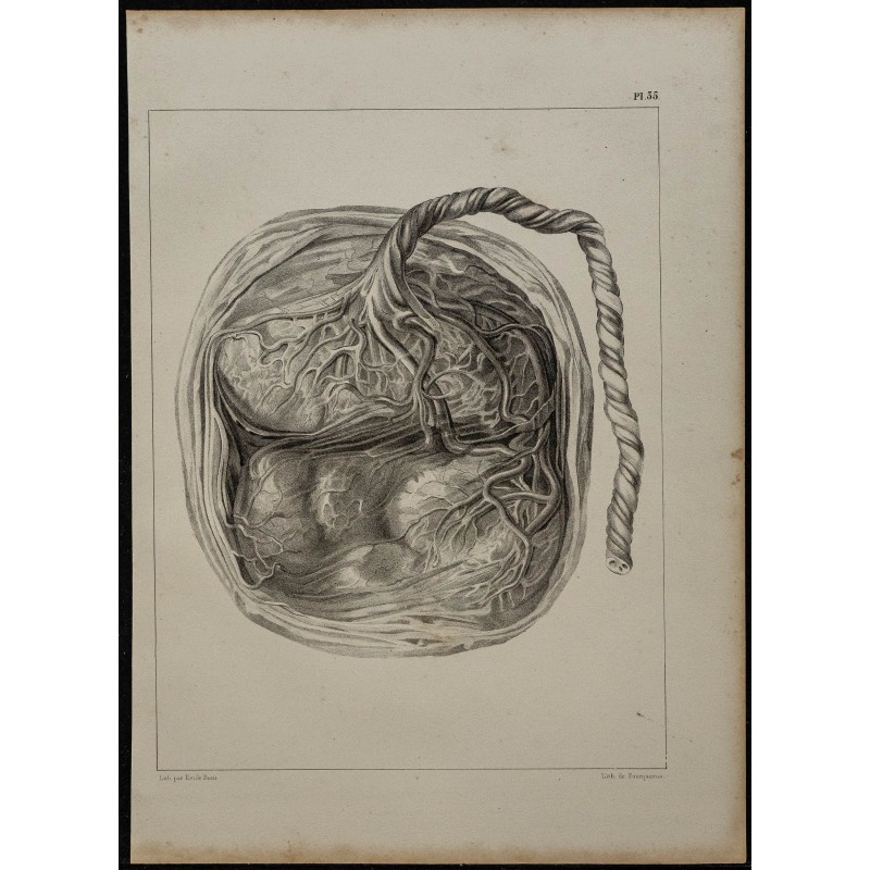1839 - Placenta bilobé de singe 