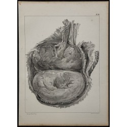 1839 - Placenta bilobé de singe 