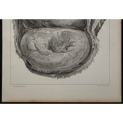 1839 - Placenta bilobé de singe 