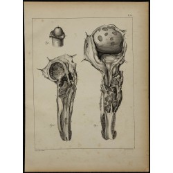 1839 - Lésions d'urètre & testicule 
