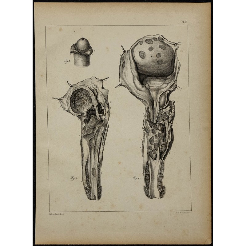 1839 - Lésions d'urètre & testicule 