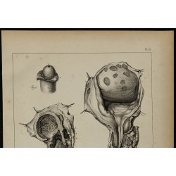 1839 - Lésions d'urètre & testicule 