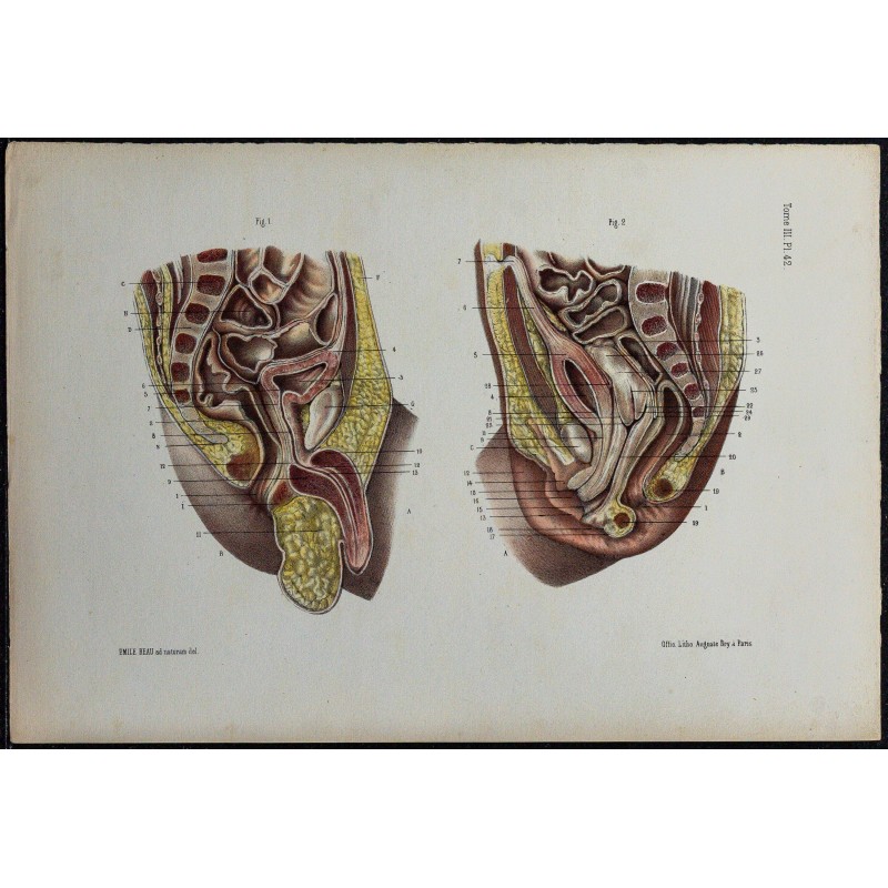 1866 - Bassin & organes pelviens néonataux 