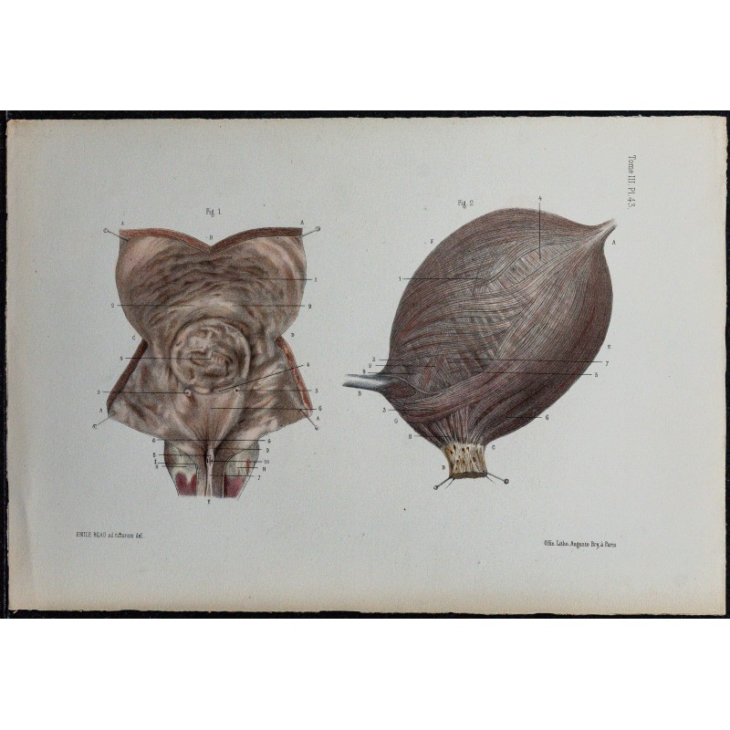 1866 - Vessie : muqueuse & musculature 