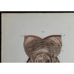 1866 - Vessie : muqueuse & musculature 