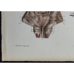 1866 - Vessie : muqueuse & musculature 