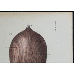 1866 - Vessie & tunique musculaire 