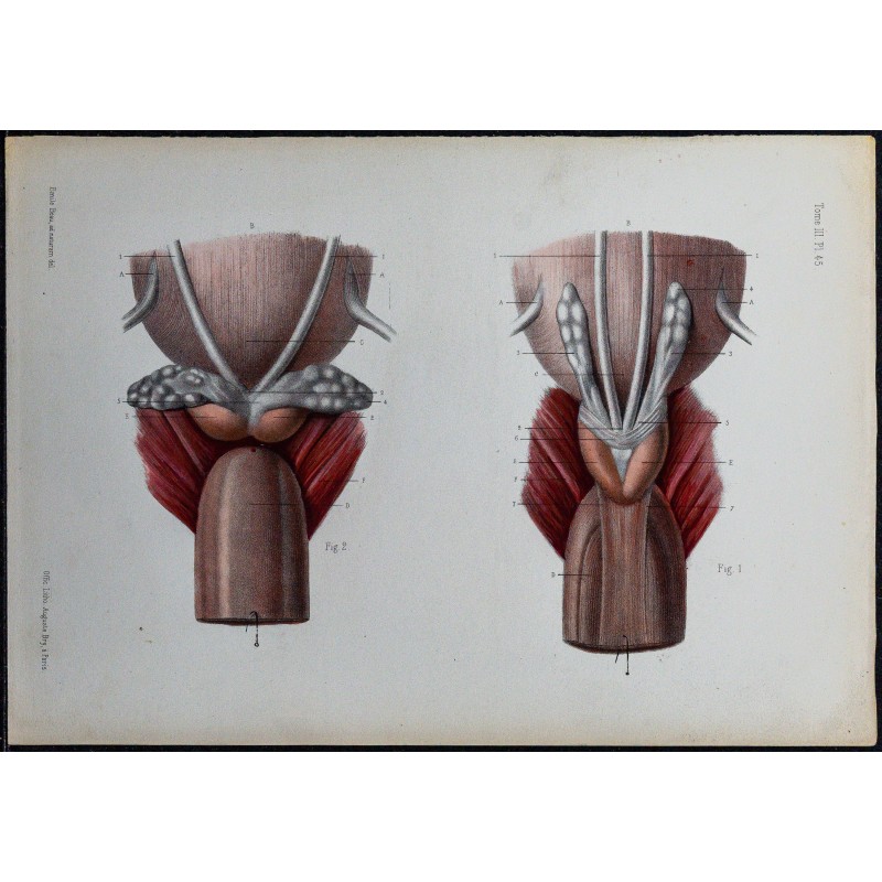 1866 - Prostate et vésicules séminales 
